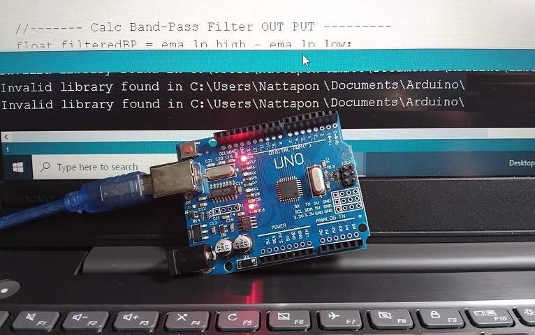 Digital Band-Pass Filter by using Arduino UNO